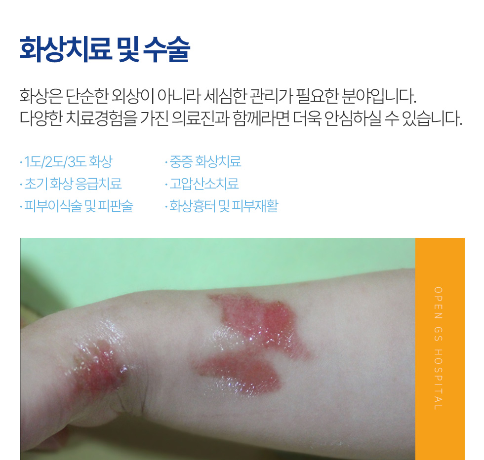 화상치료 및 수술