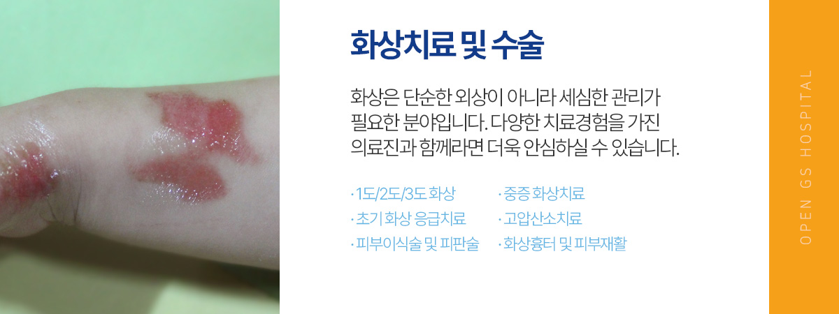 화상치료 및 수술